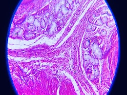 Scientists Reportedly Reversed Type 1 Diabetes by Reprogramming Patient's Fat Cells into Insulin-Producing Cells Scientists Reportedly Reversed Type 1 Diabetes by Reprogramming Patient's Fat Cells into Insulin-Producing Cells