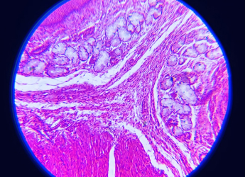Scientists Reportedly Reversed Type 1 Diabetes by Reprogramming Patient's Fat Cells into Insulin-Producing Cells