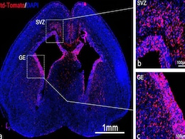 Innovative mRNA Delivery Technique Could Correct Genetic Disorders Before Birth Innovative mRNA Delivery Technique Could Correct Genetic Disorders Before Birth