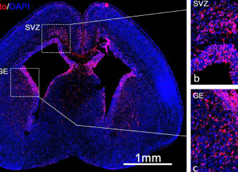Innovative mRNA Delivery Technique Could Correct Genetic Disorders Before Birth