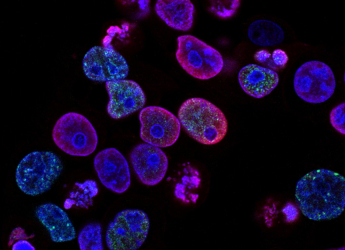 Pancreatic Cancer Awareness Low Among Under-50 Adults, Despite Rising Cases