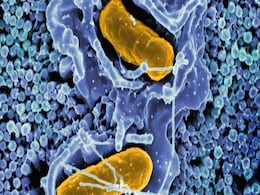 Human Immune System Might Have Evolved From the Ancient Microbe ‘Asgard’, Claims Study Human Immune System Might Have Evolved From the Ancient Microbe ‘Asgard’, Claims Study