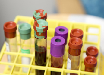 Can your Blood Type Affect Your Stroke Risk? Here&#039;s What You Need to Know