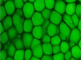 New Cartilage Type Found: Lipocartilage Resembles Fat, Boosts Elasticity New Cartilage Type Found: Lipocartilage Resembles Fat, Boosts Elasticity