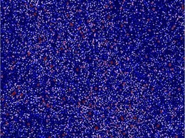 Scientists Create Most Detailed Radio Map of Early Universe Using MWA Scientists Create Most Detailed Radio Map of Early Universe Using MWA