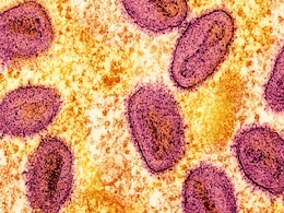 Mpox New Strain Reported in Sweden, Marks the First Case Outside of Africa Mpox New Strain Reported in Sweden, Marks the First Case Outside of Africa