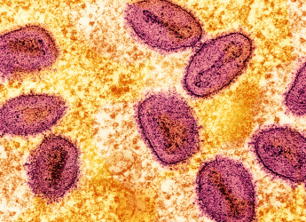 Mpox New Strain Reported in Sweden, Marks the First Case Outside of Africa