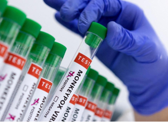 Mpox Virus Clade-2 Confirmed in Isolated Case in India, Health Ministry Activates Identification Protocols