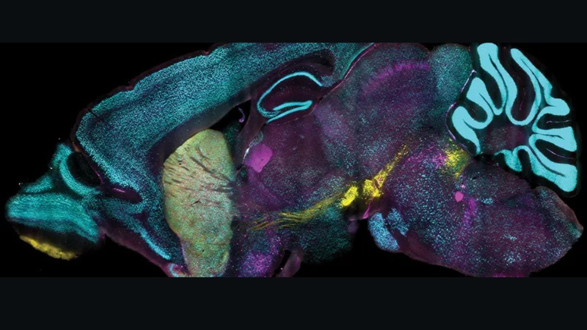 MIT&rsquo;s CuRVE Technique Achieves Uniform Protein Labeling in Intact Tissues
