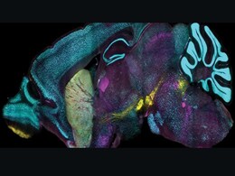 MIT’s CuRVE Technique Achieves Uniform Protein Labeling in Intact Tissues MIT’s CuRVE Technique Achieves Uniform Protein Labeling in Intact Tissues