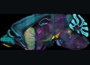 MIT&rsquo;s CuRVE Technique Achieves Uniform Protein Labeling in Intact Tissues