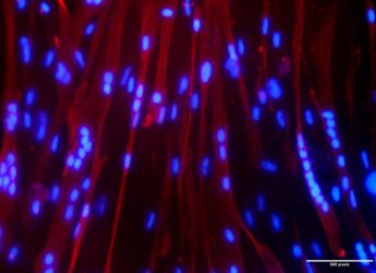 NASA-ISRO Launch Joint Space Biology Experiments on Axiom Mission 4