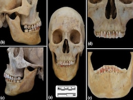 2,200-Year-Old Chinese Burial Uncovers Woman with Toxic Red-Stained Teeth 2,200-Year-Old Chinese Burial Uncovers Woman with Toxic Red-Stained Teeth