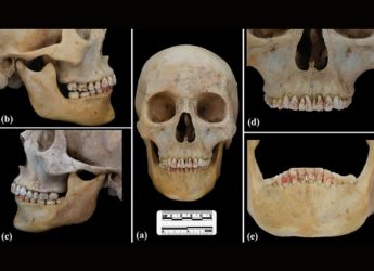 2,200-Year-Old Chinese Burial Uncovers Woman with Toxic Red-Stained Teeth