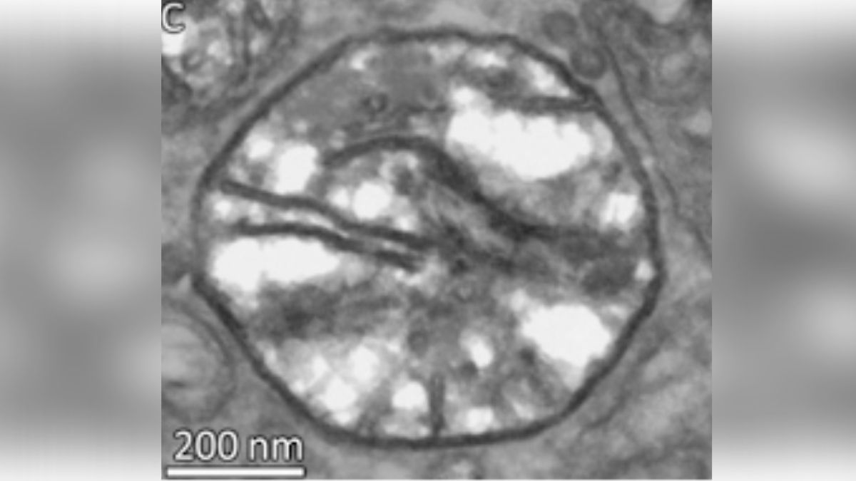 'First Non-Oxygen Breathing Animal' Accidentally Discovered by Scientists in Israel