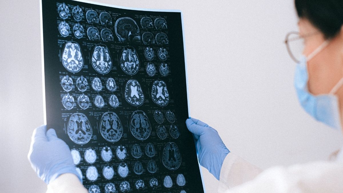 Drugs Used for Treating ADHD Could Help Treat Alzheimer’s Symptoms
