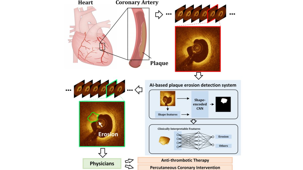 This New AI-Based Technique Can Detect Heart Conditions, May Help Avert Heart Attacks
