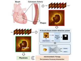 This New AI-Based Technique Can Detect Heart Conditions, May Help Avert Heart Attacks