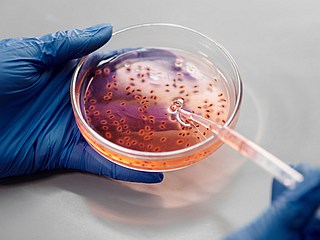 Bacteria Change Swimming Pattern While Navigating Through Tight Spaces: Researchers