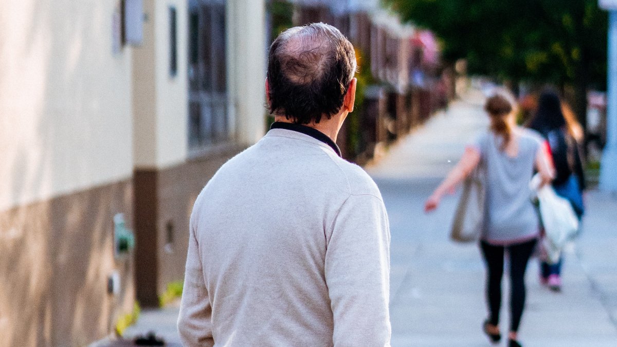 Suffering From Hair Loss or Baldness? New Study May Have Solution for You