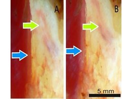 New Camera Can Help Doctors See Through the Body New Camera Can Help Doctors See Through the Body