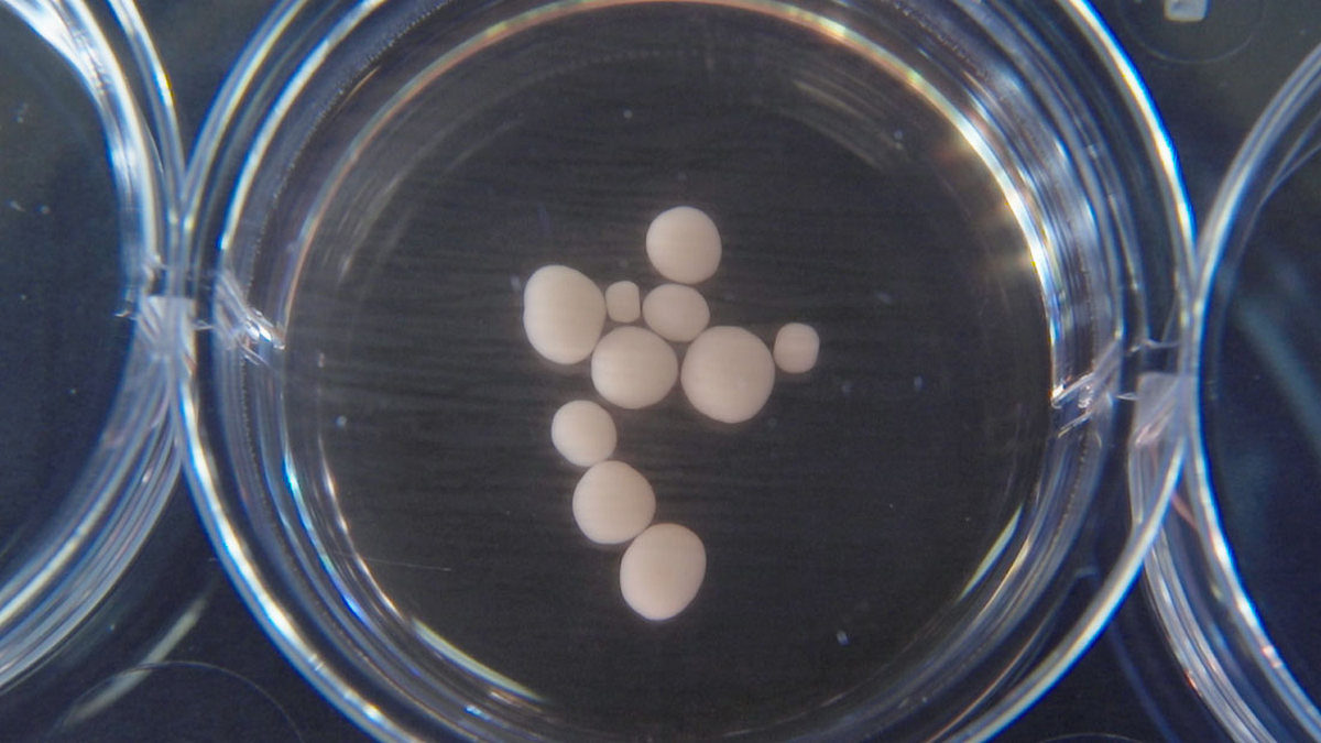 Brain Waves Detected in Mini-Brains Grown in a Lab
