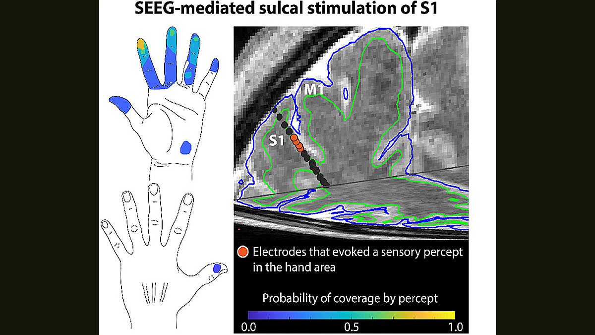 Minimally Invasive Electrode Brain Implant Can Restore Sense of Touch, Claim Researchers