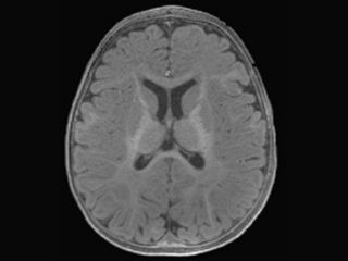 Cerebral Cortex of Developing Human Brain Mapped Using High-Quality MRI Scan Data