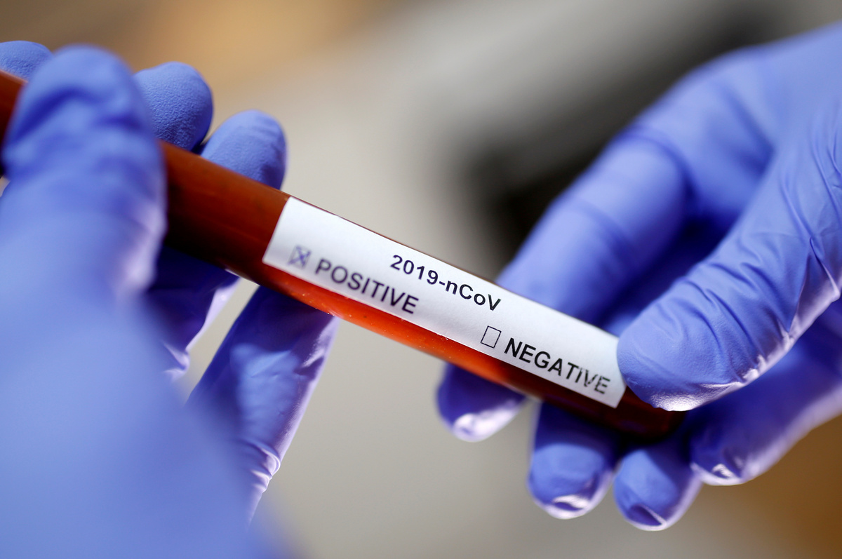 Coronavirus Cure Hopes Rise as Scientists Isolate Virus