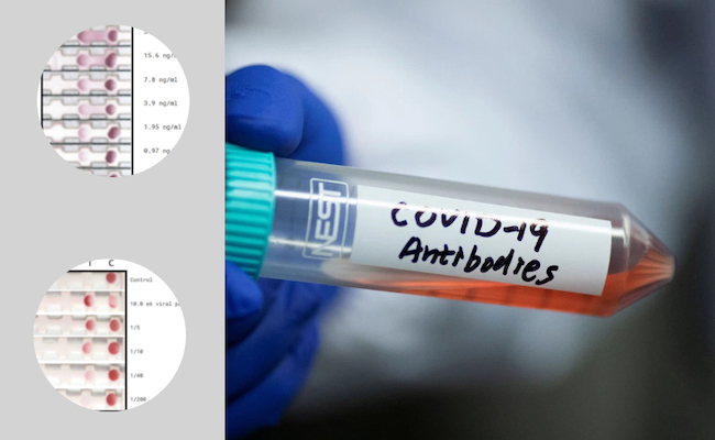 Biotech Develops E25Bio 15-Minute Test for COVID-19