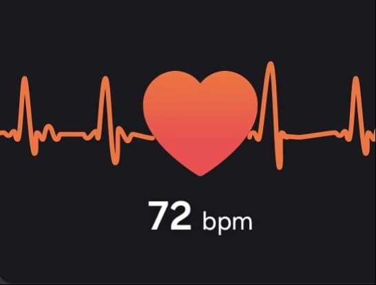 EKG E