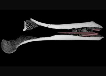 7,000-Year-Old Arrow Poison Found in South Africa, Shows Ancient Hunting Skills