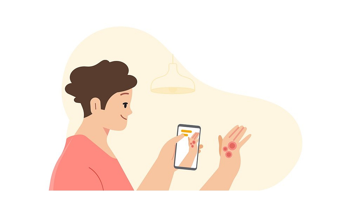 Google I/O 2021: Google Health&rsquo;s New AI Tools Can Identify Common Skin Problems, Potential TB Patients