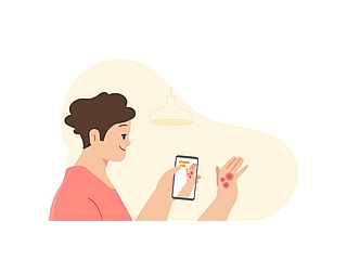 Google I/O 2021: Google Health&rsquo;s New AI Tools Can Identify Common Skin Problems, Potential TB Patients