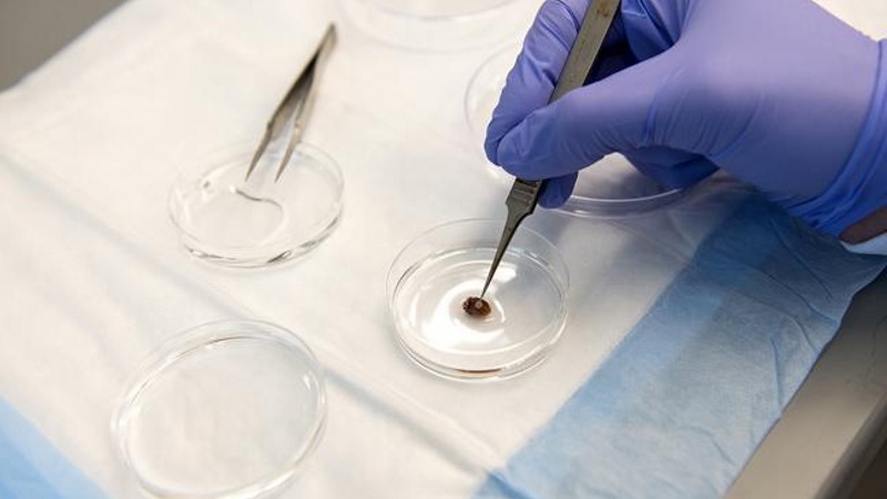 3D-Printed Patch Can Help Mend 'Broken' Hearts