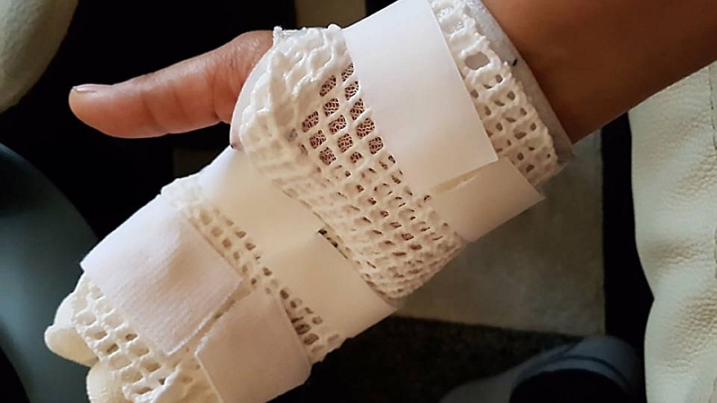 HTC Desire 10 Pro 'Explosion' That Burnt a Woman's Hand Is Being Investigated by the Company