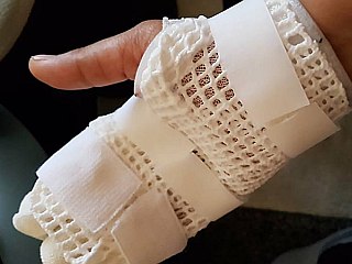 HTC Desire 10 Pro &#039;Explosion&#039; That Burnt a Woman&#039;s Hand Is Being Investigated by the Company