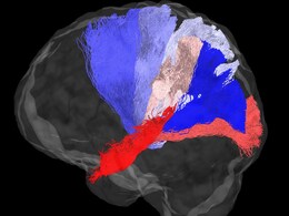 IISc Researchers Use GPUs to Discover Human Brain Activity in Recent Study IISc Researchers Use GPUs to Discover Human Brain Activity in Recent Study