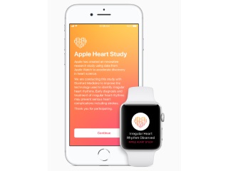 Apple Watch Users Can Now Enrol in Stanford Irregular Heart Rate Study