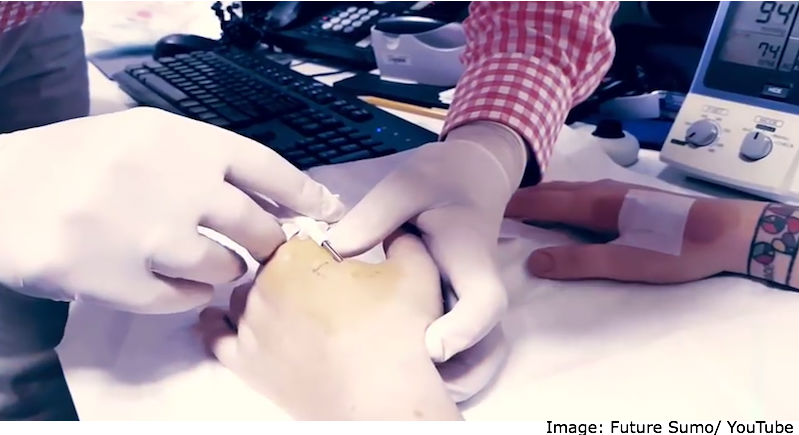 Implanted Microchips Give Jedi Powers to Lifelong Star Wars Fan