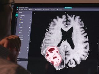 Microsoft, Apollo Hospitals Partner to Use AI for Cardiac Diseases