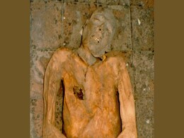 Genome of E.Coli Bacterium Reconstructed Using Gallstone From 600-Year-Old Mummy Genome of E.Coli Bacterium Reconstructed Using Gallstone From 600-Year-Old Mummy