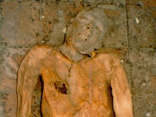 Genome of E.Coli Bacterium Reconstructed Using Gallstone From 600-Year-Old Mummy