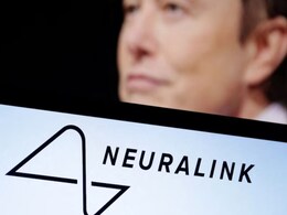 Elon Musk’s Neuralink Cleared to Start Brain Chip Trial in Canada Elon Musk’s Neuralink Cleared to Start Brain Chip Trial in Canada