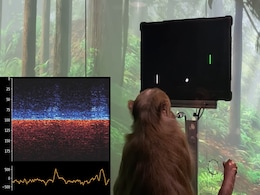 Elon Musk Claims His Neuralink Brain Chip Could ‘Cure’ Tinnitus in 5 Years. but Don’t Hold Your Breath Elon Musk Claims His Neuralink Brain Chip Could ‘Cure’ Tinnitus in 5 Years. but Don’t Hold Your Breath