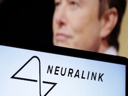 Would You Let Elon Musk Implant a Device in Your Brain? Would You Let Elon Musk Implant a Device in Your Brain?