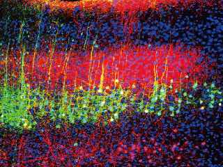 New Study Unravels How Sound Helps Relieve Pain in Mice