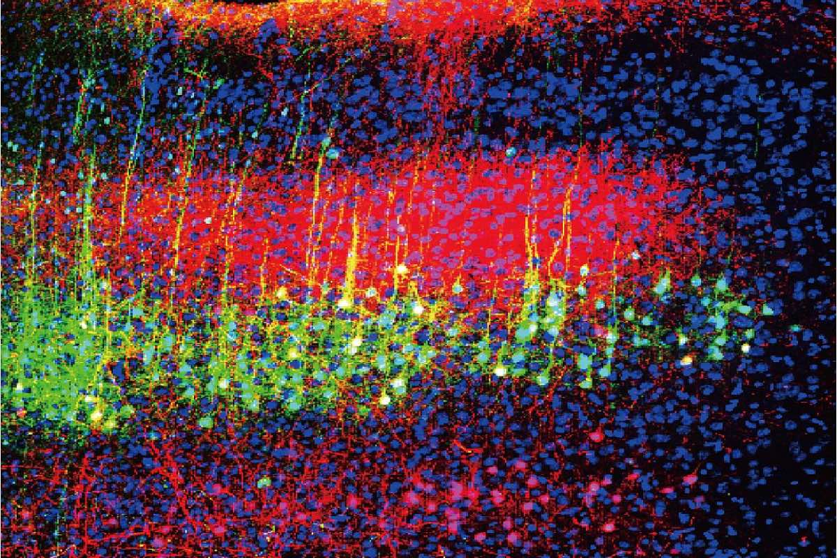 New Study Unravels How Sound Helps Relieve Pain in Mice