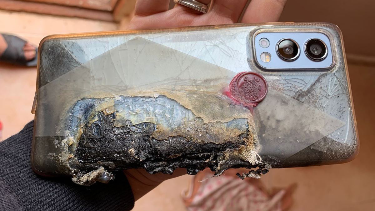 OnePlus Nord 2 5G User Who Suffered Severe Burns Due to Explosion Gets Refund, Medical Expenses: Report