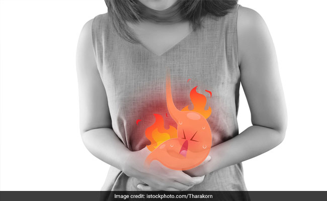 Peptic Ulcers: Causes, Symptoms And Home Remedies